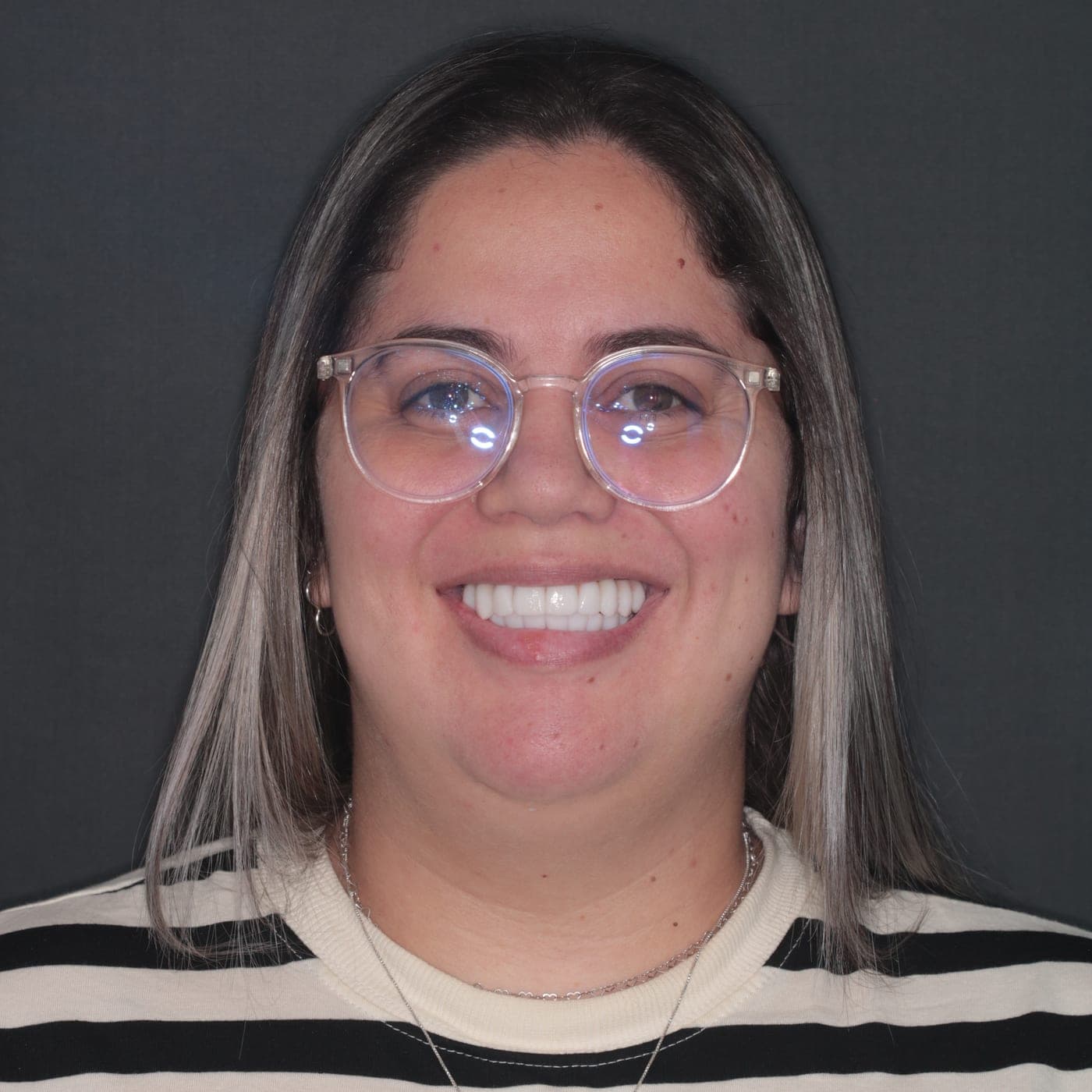 Carol depois — Reabilitação Estética